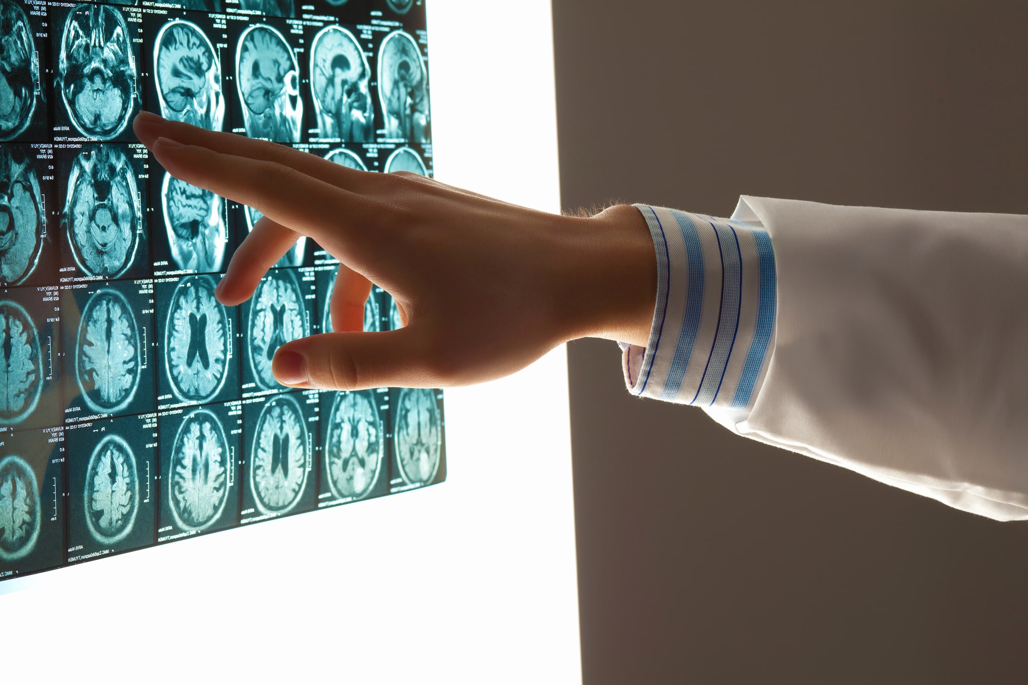 brain injury lawyer New Brunswick, NJ